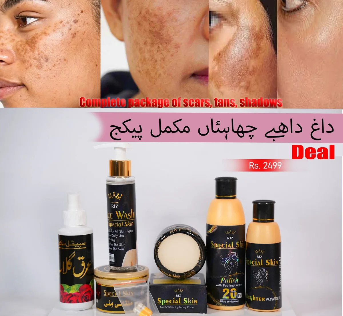 Pigmentation All Package