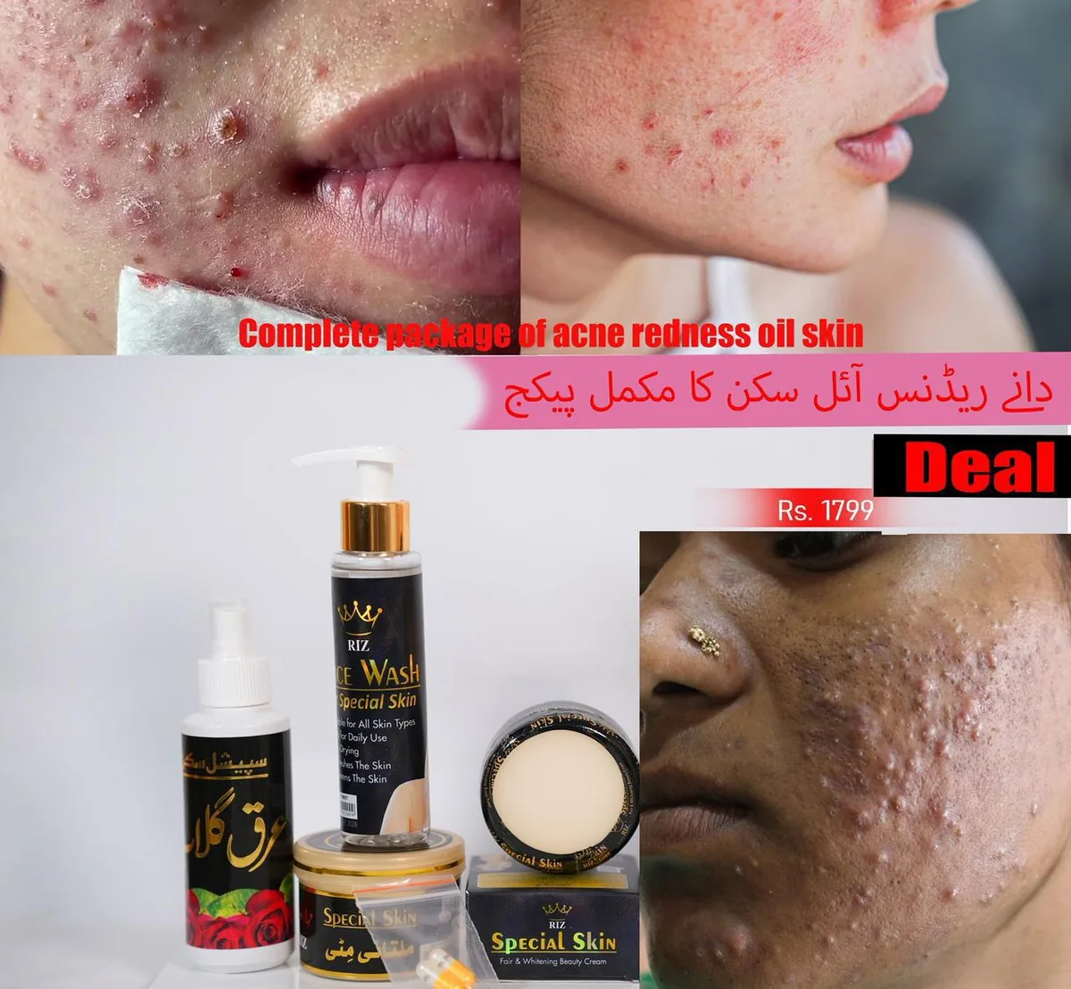 دانوں اور ریڈنیس کا پیکج